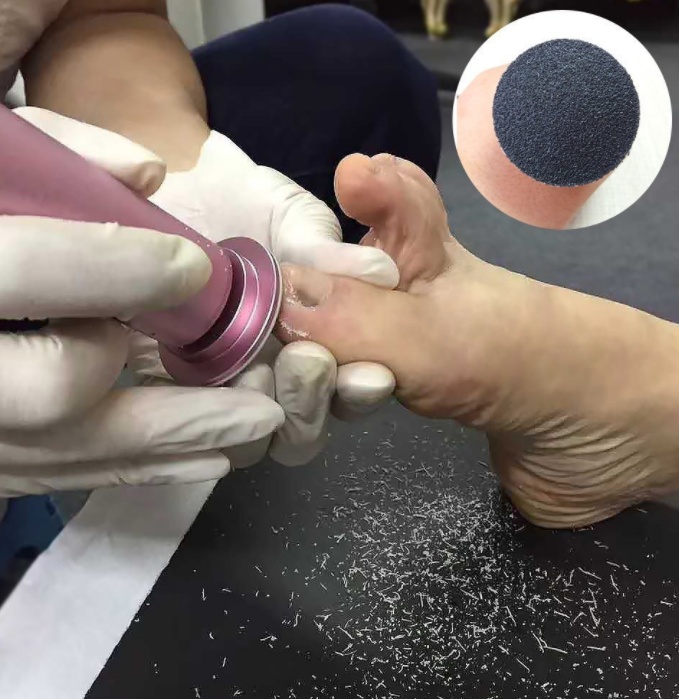 Electric Pedicure Foot Care Tool Files Pedicure Callus Remover Rechargeable Sawing File For Feet Dead Skin Callus Peel Remover - الصورة 4
