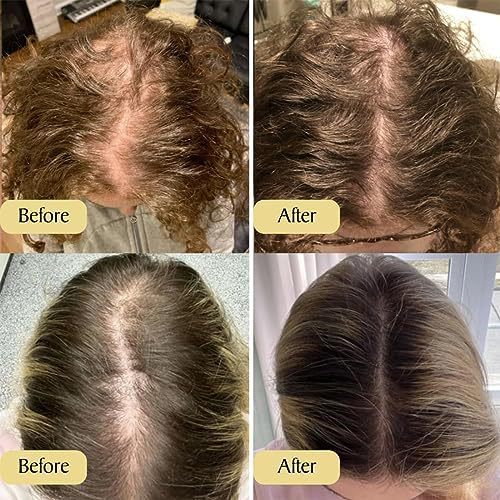 Moisturizing Repair Delicate And Soft Hair Care Essential Oil - Image 5