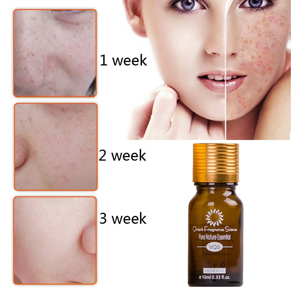 Dredge Meridian Skin Care Natural Pure Removal Acne Stretch Marks Scar Remova - الصورة 3