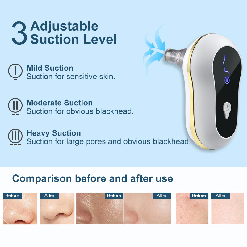 Suction Blackhead Remover Kit Electric Facial Pore Cleanser Acne Cleaner - الصورة 7
